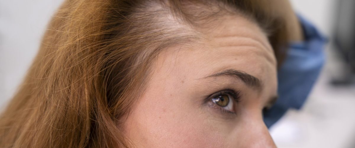woman-getting-hair-loss-treatment-clinic